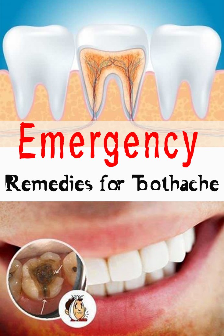 Emergency Remedies for Toothache - Everything in one place